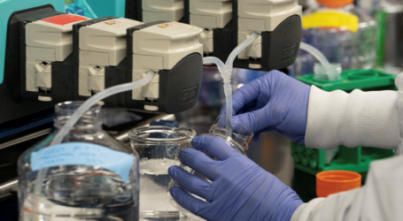 Tι είναι η χλωροκίνη; Η αποκάλυψη Τσιόδρα ότι την παίρνουν όλοι οι ασθενείς με κορονοϊό στα ελληνικά νοσοκομεία