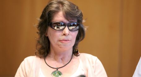 Κούνεβα για την επίθεση με βιτριόλι στην Καλλιθέα: Τώρα ξεκινάει ο Γολγοθάς της κοπέλας. Για 20 μέρες θα καίγεται…