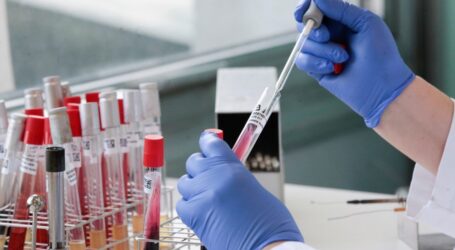 Ελπιδοφόρα νέα: Επιστήμονες δημιούργησαν σε εργαστήριο αντίσωμα που «νίκησε» τον κορωνοϊό