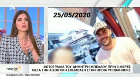 Ο Δημήτρης Μπέλλος έκανε εμφύτευση μαλλιών