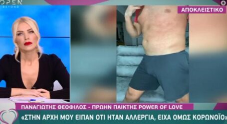Πρώην παίκτης ριάλιτι μιλά για την περιπέτεια με τον κορονοϊό – Δείχνει τα σημάδια που έχει σε όλο το σώμα του