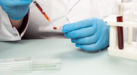 Νέα έρευνα απαντά εάν τελικά η ομάδα αίματος «δείχνει» τον κίνδυνο σοβαρής Covid-19